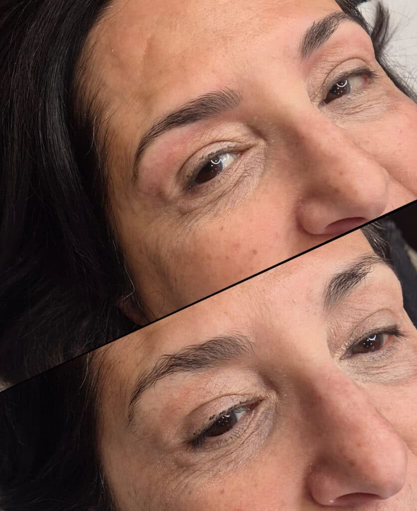 Restructuration sourcils Charlène RAMEAU 71 (3)